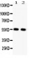 Anti-GLUT4 Picoband Antibody